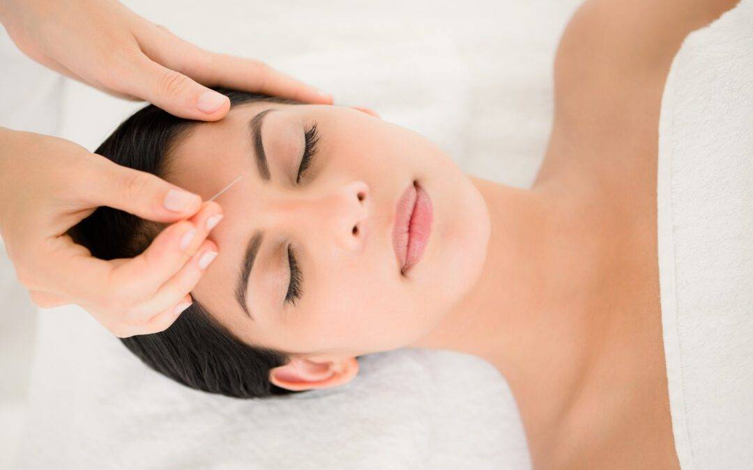 Woman in an acupuncture therapy at the health spa